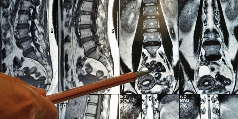 diagnosis spine disorders diseases deformities